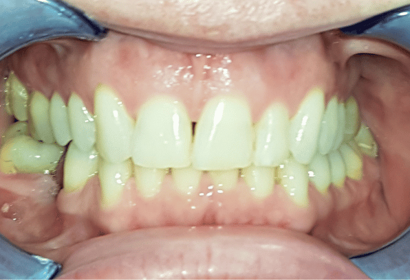 After - Stamford Dental Care