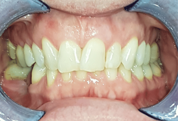Before - Stamford Dental Care