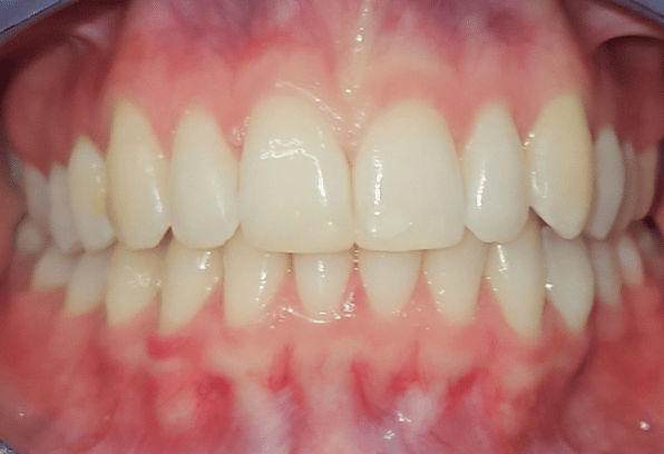 After - Stamford Dental Care