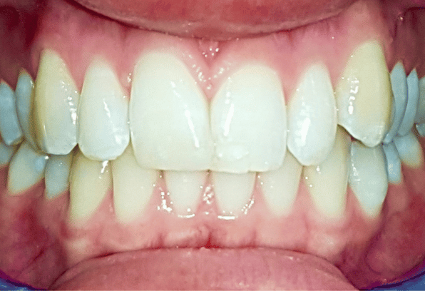 Before - Stamford Dental Care