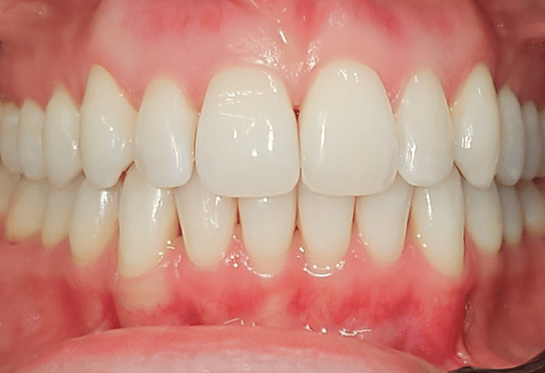 After - Stamford Dental Care