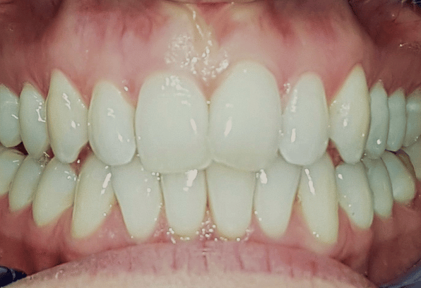 Before - Stamford Dental Care