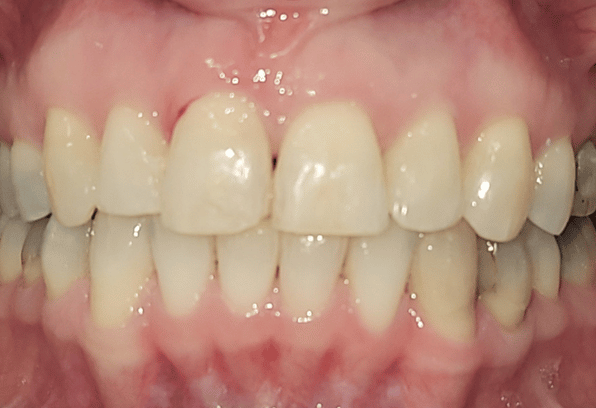After - Stamford Dental Care