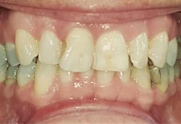 Before - Stamford Dental Care