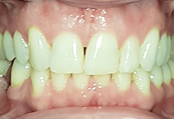After - Stamford Dental Care
