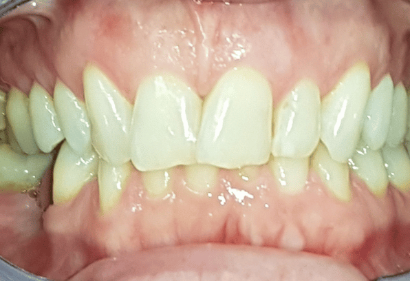 Before - Stamford Dental Care