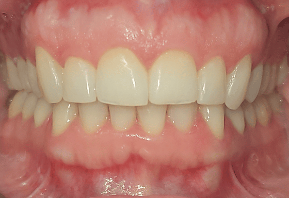 After Face - Stamford Dental Care