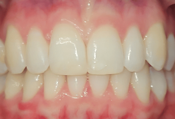 After - Stamford Dental Care