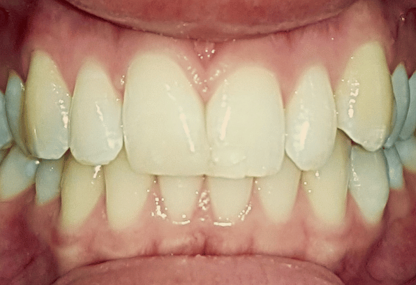 Before - Stamford Dental Care