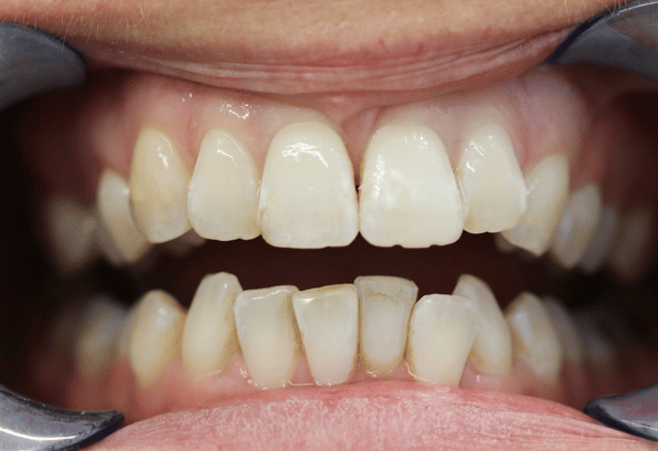 After - Stamford Dental Care