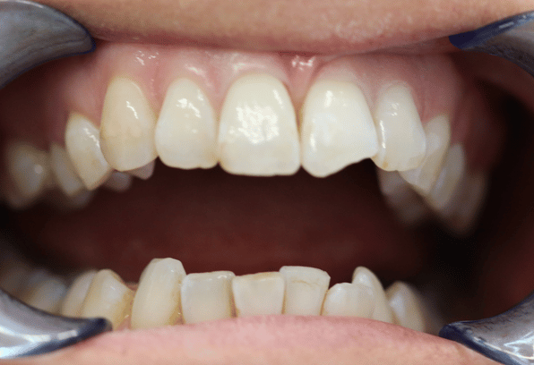 Before - Stamford Dental Care
