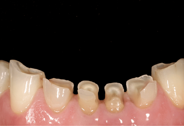 Before - Stamford Dental Care