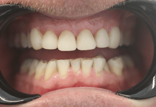 After - Stamford Dental Care