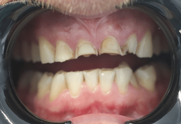 Before - Stamford Dental Care