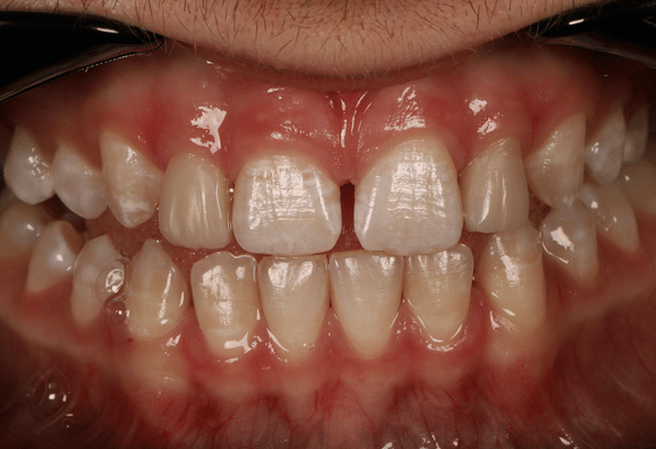 After - Stamford Dental Care