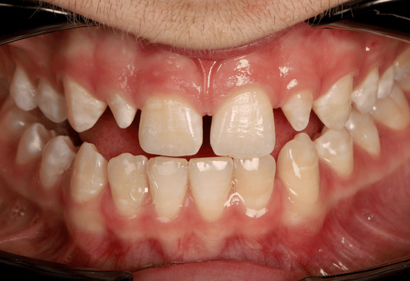 Before - Stamford Dental Care