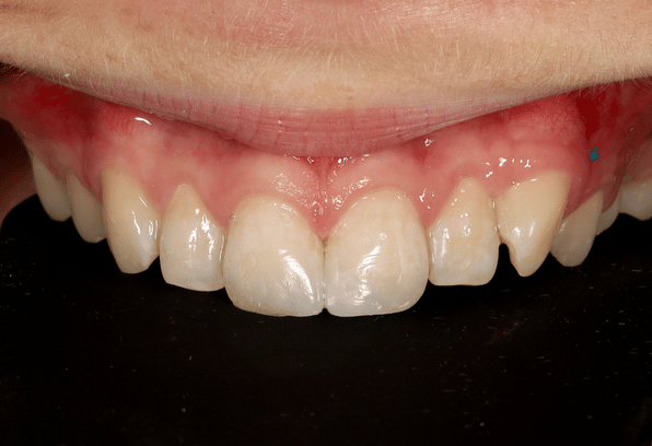 After - Stamford Dental Care
