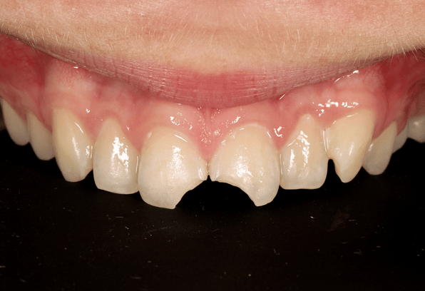 Before - Stamford Dental Care