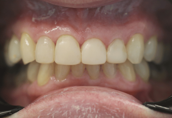 After - Stamford Dental Care