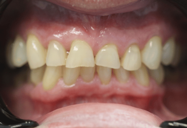 Before - Stamford Dental Care