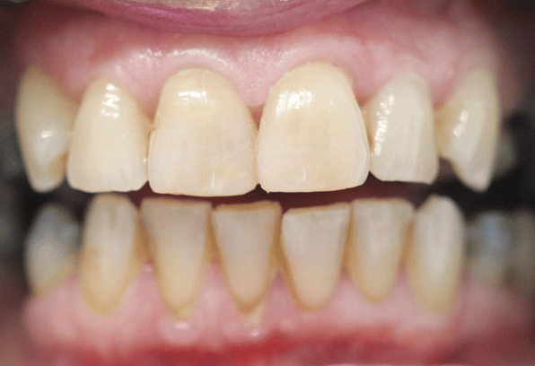 After - Stamford Dental Care