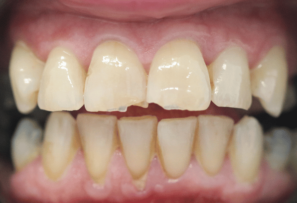 Before - Stamford Dental Care