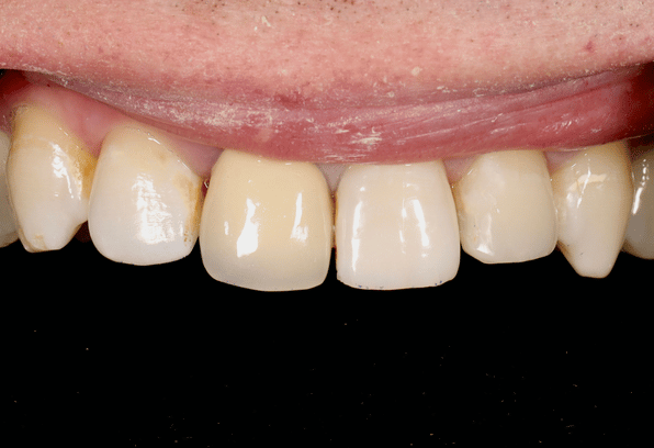 After - Stamford Dental Care