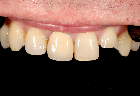 Before - Stamford Dental Care