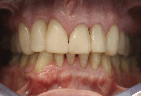 After - Stamford Dental Care