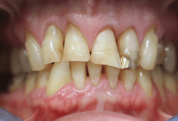 Before - Stamford Dental Care
