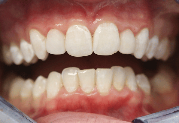 After - Stamford Dental Care