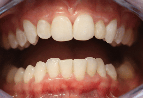 Before - Stamford Dental Care