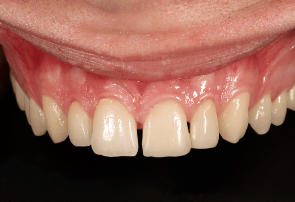 After - Stamford Dental Care