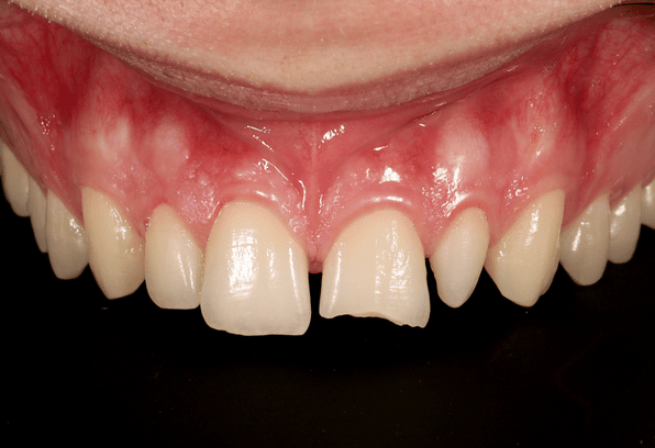 Before - Stamford Dental Care