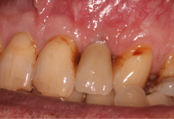 After - Stamford Dental Care