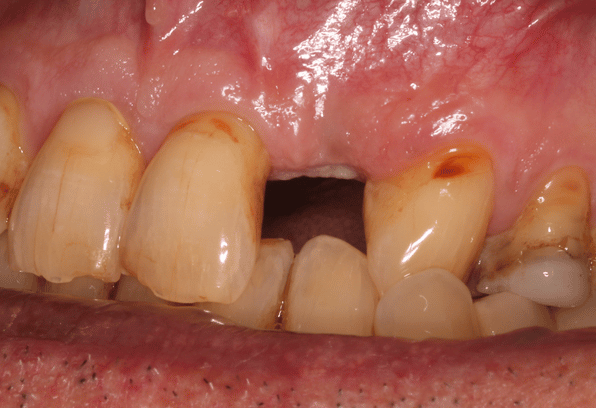 Before - Stamford Dental Care