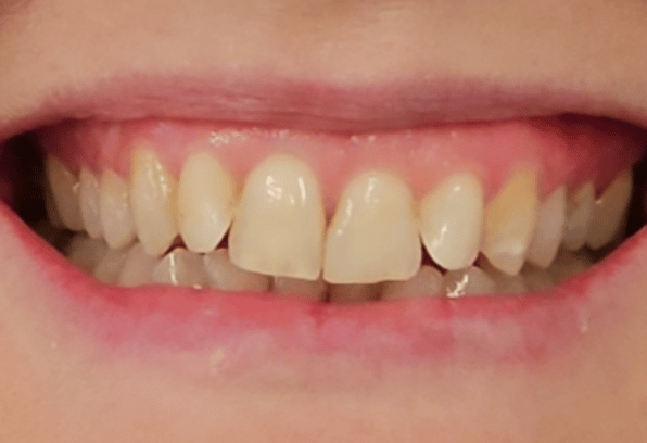 Before- Face - Stamford Dental Care