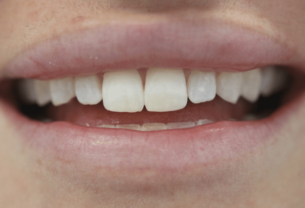 After - Stamford Dental Care