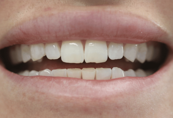 Before - Stamford Dental Care