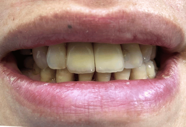 After - Stamford Dental Care