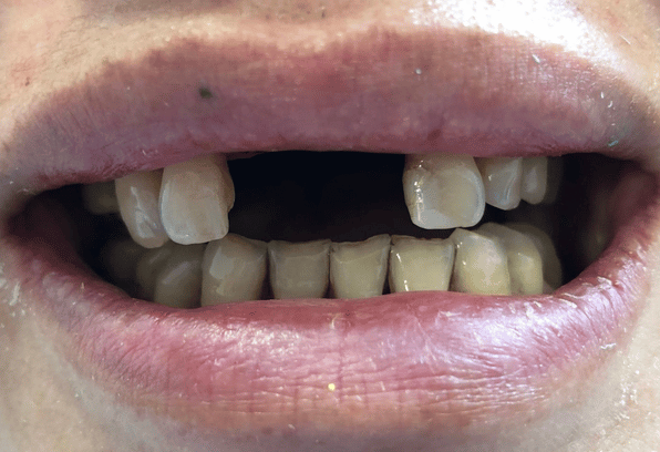 Before - Stamford Dental Care