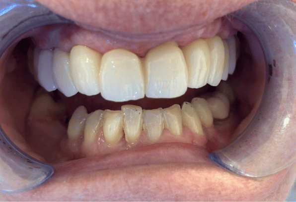 After Face - Stamford Dental Care