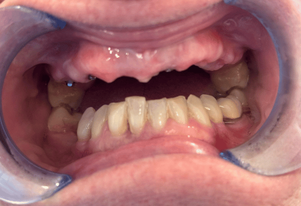 Before- Face - Stamford Dental Care