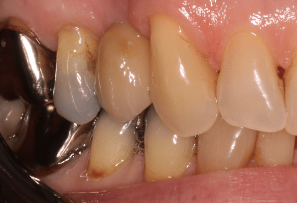 After - Stamford Dental Care