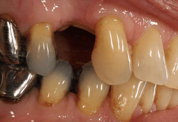 Before - Stamford Dental Care