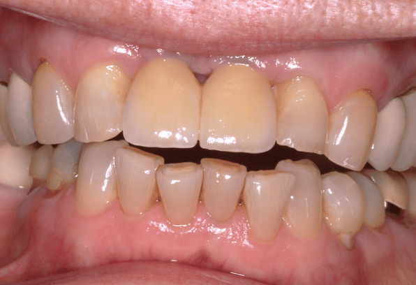 After - Stamford Dental Care