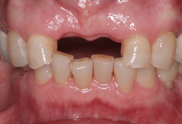Before - Stamford Dental Care