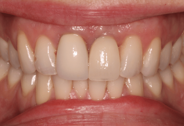 After - Stamford Dental Care