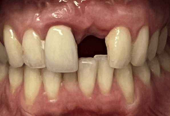 Before - Stamford Dental Care