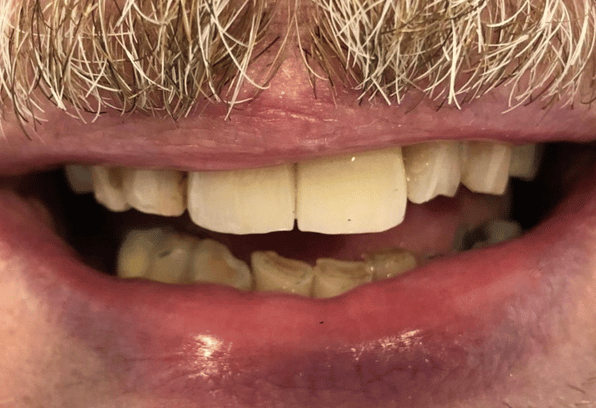 After - Stamford Dental Care